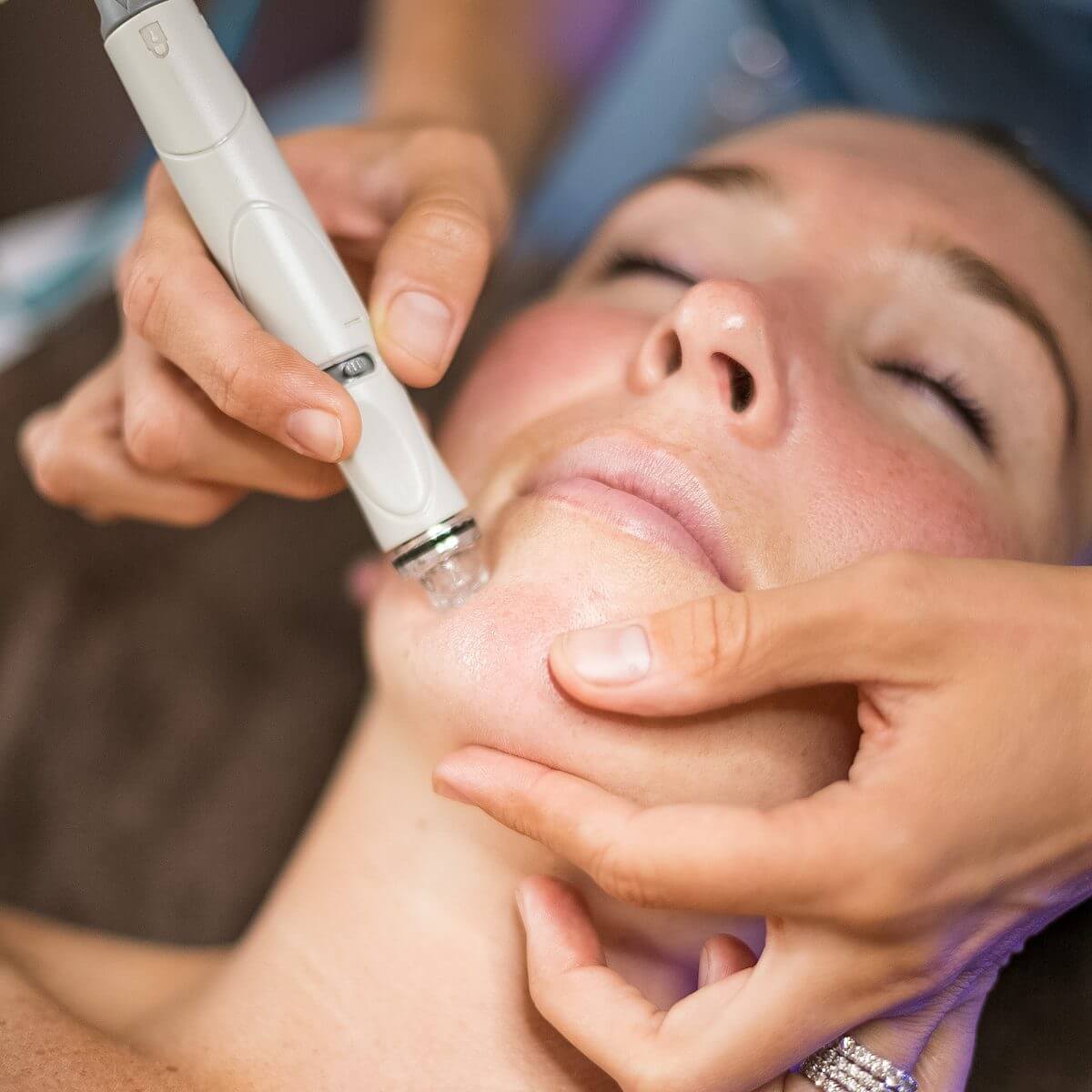 Microneedling skincare treatment at Inde Salon, Quincy MA